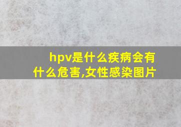 hpv是什么疾病会有什么危害,女性感染图片