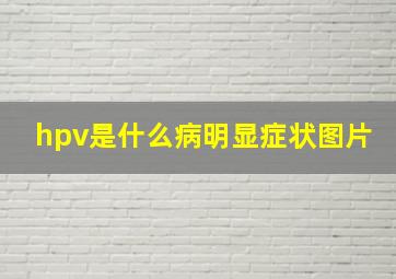 hpv是什么病明显症状图片