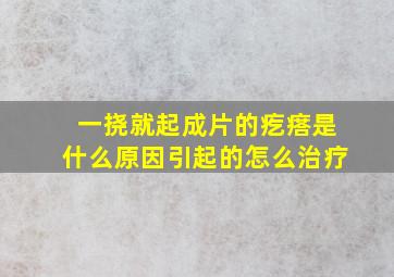 一挠就起成片的疙瘩是什么原因引起的怎么治疗