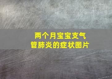 两个月宝宝支气管肺炎的症状图片