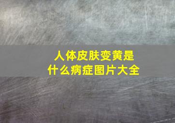 人体皮肤变黄是什么病症图片大全