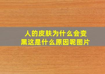 人的皮肤为什么会变黑这是什么原因呢图片