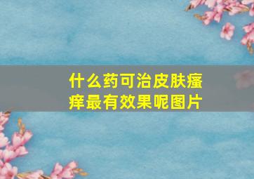 什么药可治皮肤瘙痒最有效果呢图片