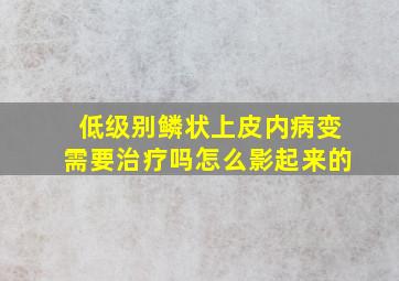 低级别鳞状上皮内病变需要治疗吗怎么影起来的