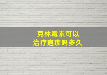 克林霉素可以治疗疱疹吗多久