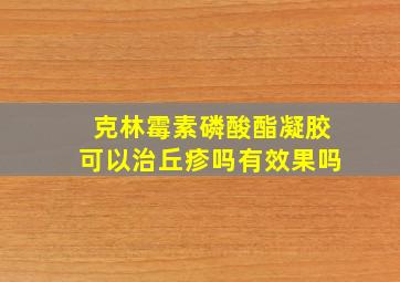 克林霉素磷酸酯凝胶可以治丘疹吗有效果吗