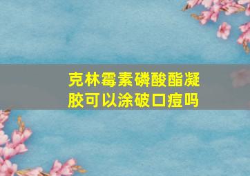 克林霉素磷酸酯凝胶可以涂破口痘吗