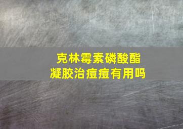 克林霉素磷酸酯凝胶治痘痘有用吗