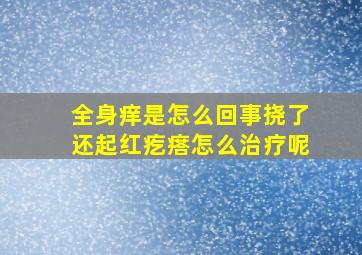 全身痒是怎么回事挠了还起红疙瘩怎么治疗呢