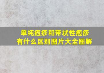 单纯疱疹和带状性疱疹有什么区别图片大全图解