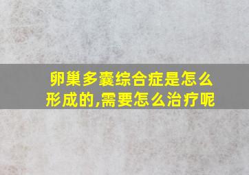 卵巢多囊综合症是怎么形成的,需要怎么治疗呢