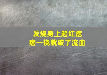 发烧身上起红疙瘩一挠就破了流血