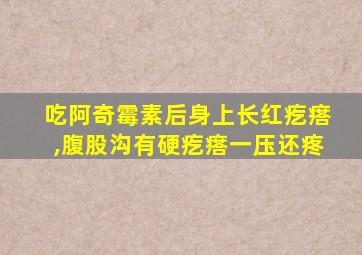 吃阿奇霉素后身上长红疙瘩,腹股沟有硬疙瘩一压还疼