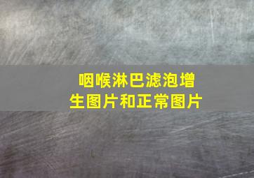 咽喉淋巴滤泡增生图片和正常图片