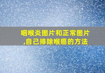 咽喉炎图片和正常图片,自己排除喉癌的方法