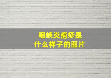 咽峡炎疱疹是什么样子的图片