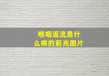 喉咽返流是什么病的前兆图片