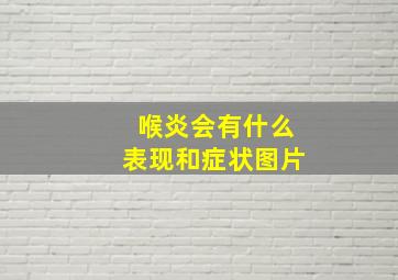 喉炎会有什么表现和症状图片