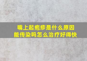 嘴上起疱疹是什么原因能传染吗怎么治疗好得快