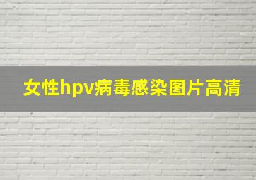 女性hpv病毒感染图片高清