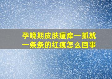 孕晚期皮肤瘙痒一抓就一条条的红痕怎么回事