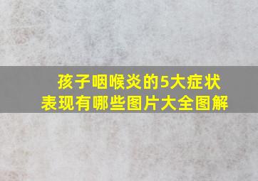 孩子咽喉炎的5大症状表现有哪些图片大全图解