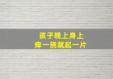 孩子晚上身上痒一挠就起一片