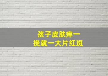 孩子皮肤痒一挠就一大片红斑