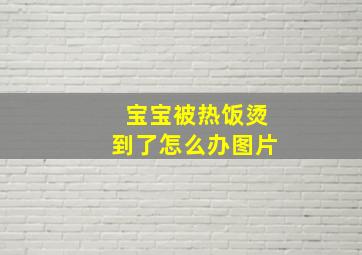 宝宝被热饭烫到了怎么办图片