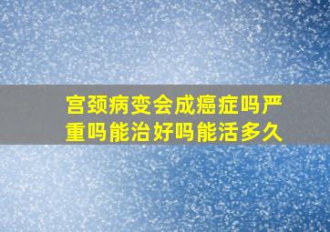 宫颈病变会成癌症吗严重吗能治好吗能活多久