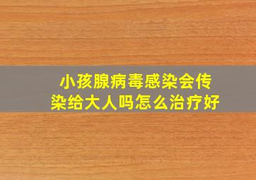 小孩腺病毒感染会传染给大人吗怎么治疗好