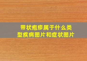 带状疱疹属于什么类型疾病图片和症状图片