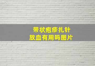 带状疱疹扎针放血有用吗图片