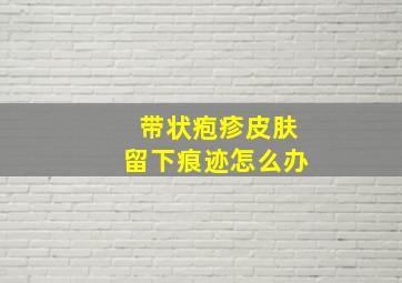 带状疱疹皮肤留下痕迹怎么办