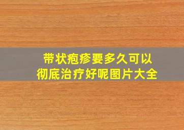 带状疱疹要多久可以彻底治疗好呢图片大全