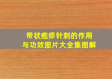 带状疱疹针刺的作用与功效图片大全集图解