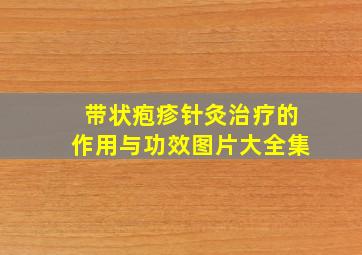 带状疱疹针灸治疗的作用与功效图片大全集