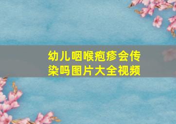 幼儿咽喉疱疹会传染吗图片大全视频