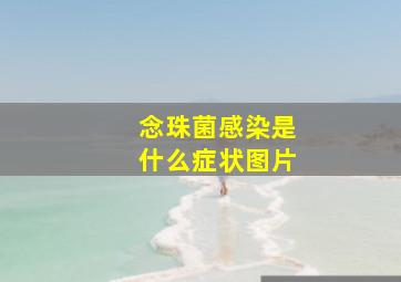 念珠菌感染是什么症状图片