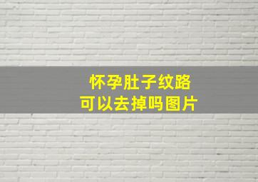 怀孕肚子纹路可以去掉吗图片