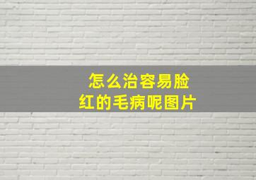 怎么治容易脸红的毛病呢图片