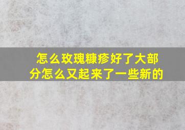 怎么玫瑰糠疹好了大部分怎么又起来了一些新的