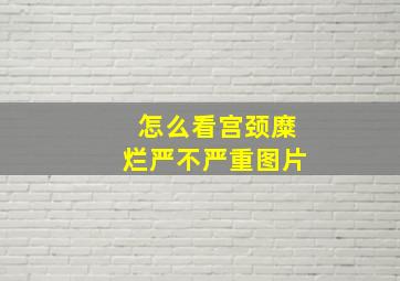 怎么看宫颈糜烂严不严重图片