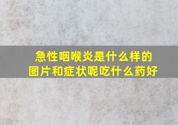 急性咽喉炎是什么样的图片和症状呢吃什么药好