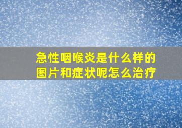 急性咽喉炎是什么样的图片和症状呢怎么治疗