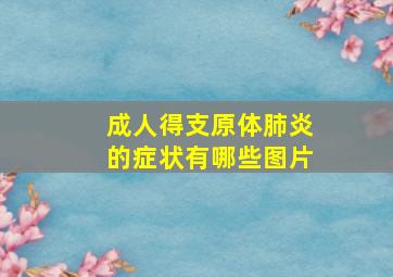 成人得支原体肺炎的症状有哪些图片