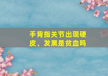 手背指关节出现硬皮、发黑是贫血吗