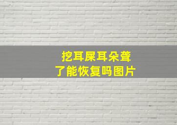 挖耳屎耳朵聋了能恢复吗图片