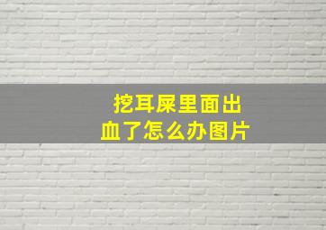 挖耳屎里面出血了怎么办图片