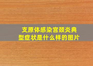 支原体感染宫颈炎典型症状是什么样的图片